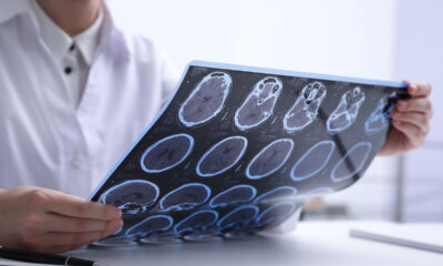 Profesional médico examinando radiografías de escáner cerebral con varias secciones neurológicas.