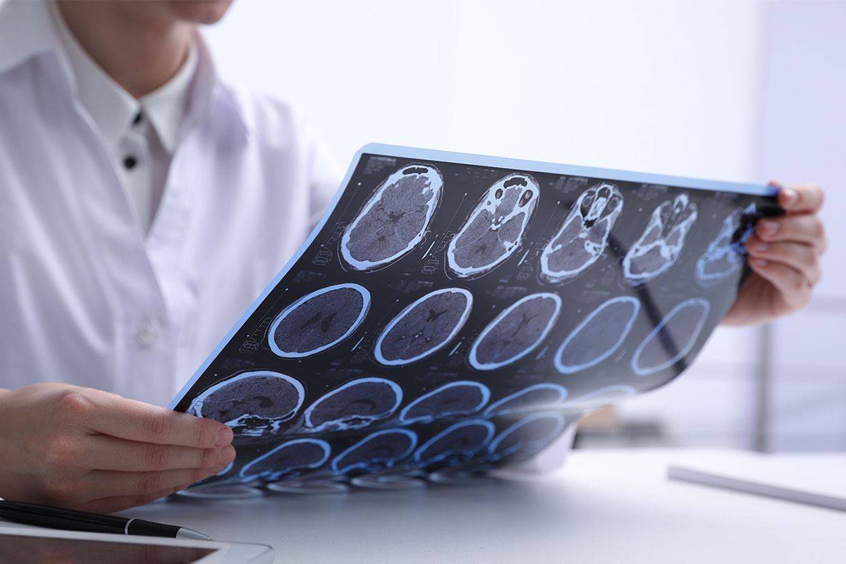 Profesional médico examinando radiografías de escáner cerebral con varias secciones neurológicas.