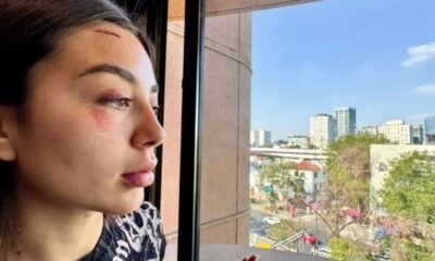 Mujer joven con lesiones visibles en rostro y frente observa por la ventana hacia una ciudad; representa denuncia de violencia policial y debate sobre justicia y derechos humanos.