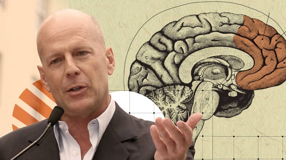 Bruce Willis hablando frente a un micrófono con fondo ilustrado de un cerebro, relacionado con investigación médica sobre demencia frontotemporal.