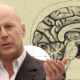 Bruce Willis hablando frente a un micrófono con fondo ilustrado de un cerebro, relacionado con investigación médica sobre demencia frontotemporal.
