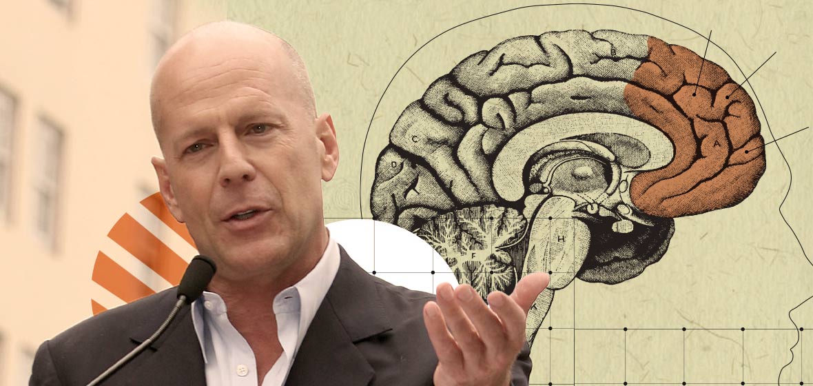 Bruce Willis hablando frente a un micrófono con fondo ilustrado de un cerebro, relacionado con investigación médica sobre demencia frontotemporal.