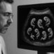 Ultrasonido médico que muestra múltiples fetos subdesarrollados dentro de un solo cuerpo, caso conocido como fetus in fetu.