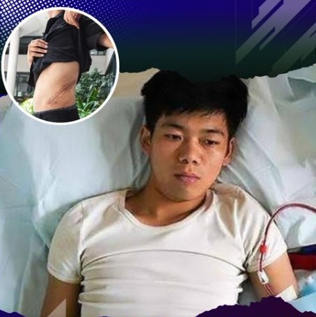 Joven recostado en cama hospitalaria tras haber vendido un riñón; imagen secundaria muestra cicatriz en el costado.