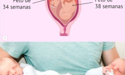 Ilustración comparativa de dos fetos en el útero con diferentes semanas de gestación y fotografía de dos recién nacidos.