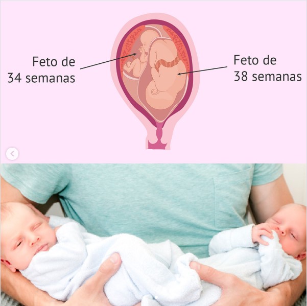 Ilustración comparativa de dos fetos en el útero con diferentes semanas de gestación y fotografía de dos recién nacidos.