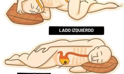 Ilustración comparativa de posiciones para dormir mostrando jugo gástrico y estómago en lado izquierdo y derecho.