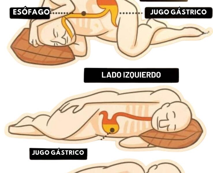 Ilustración comparativa de posiciones para dormir mostrando jugo gástrico y estómago en lado izquierdo y derecho.