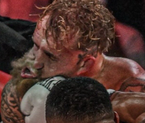 Rostro inflamado de Jake Paul tras recibir un fuerte golpe durante un combate de boxeo profesional.