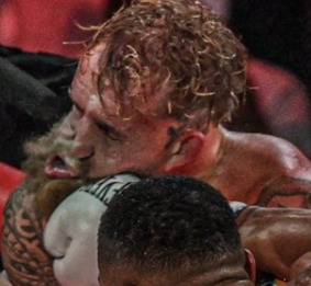 Rostro inflamado de Jake Paul tras recibir un fuerte golpe durante un combate de boxeo profesional.