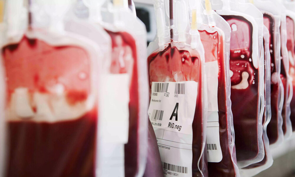 Bolsas de sangre utilizadas para transfusiones médicas en hospital.