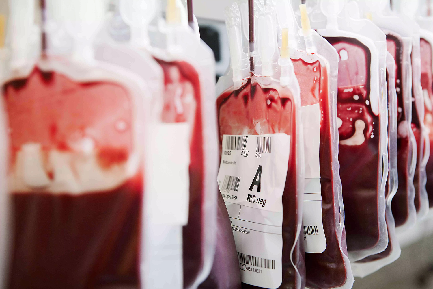 Bolsas de sangre utilizadas para transfusiones médicas en hospital.