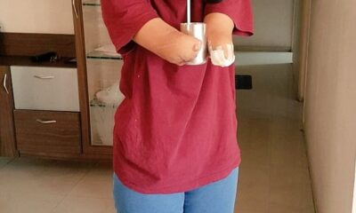 Mujer con doble trasplante de brazos sosteniendo una taza y bebiendo con popote.