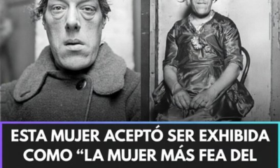 Mary Ann Bevan acromegalia historia mujer resiliencia siglo XX