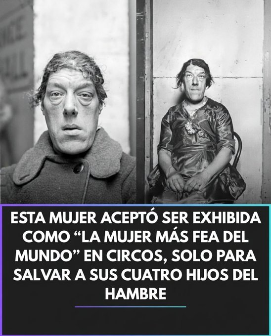 Mary Ann Bevan acromegalia historia mujer resiliencia siglo XX