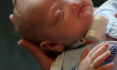 Bebé en brazos de un adulto en contexto de salud y cuidado, relacionado con enfermedad congénita