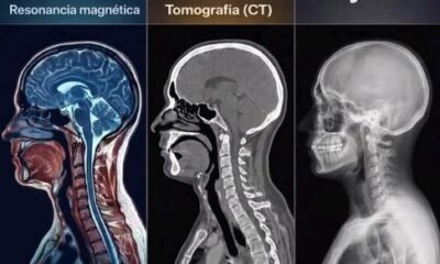 Comparación entre resonancia magnética, tomografía y rayos X mostrando diferencias en diagnóstico médico