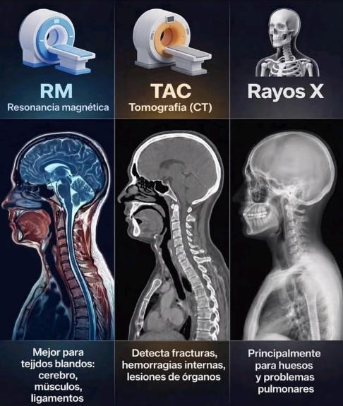 Comparación entre resonancia magnética, tomografía y rayos X mostrando diferencias en diagnóstico médico