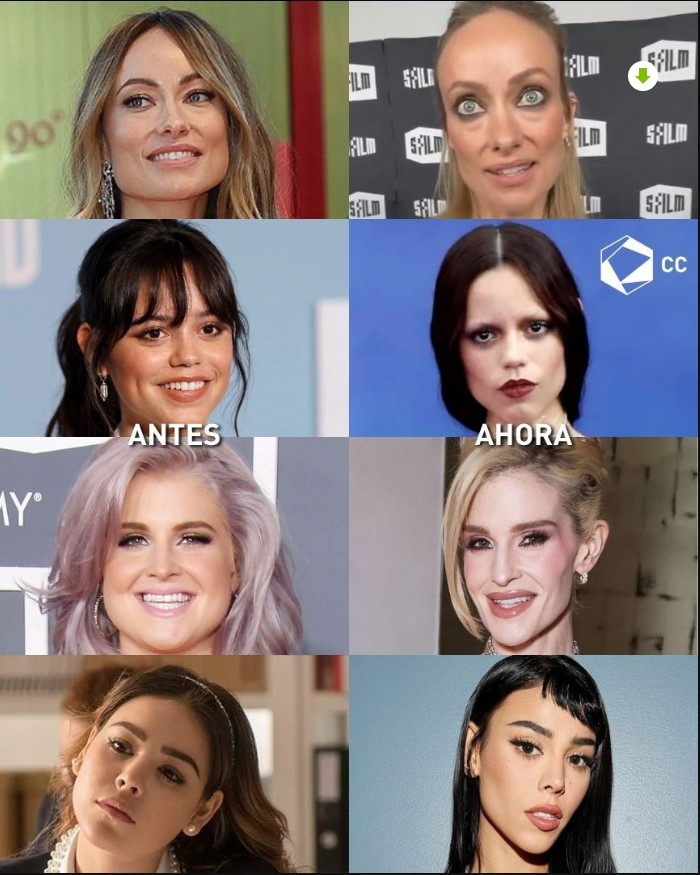 Comparación de cambios físicos en celebridades reflejando tendencias de delgadez en la actualidad