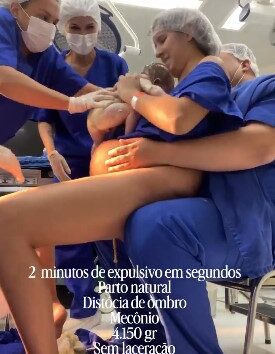 Personal médico atiende un parto de alta complejidad relacionado con macrosomía fetal y distocia de hombros durante el nacimiento de un bebé de 4.15 kilogramos.