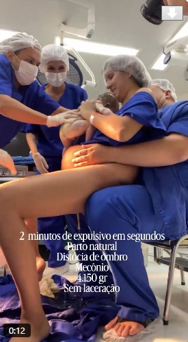 Personal médico atiende un parto de alta complejidad relacionado con macrosomía fetal y distocia de hombros durante el nacimiento de un bebé de 4.15 kilogramos.